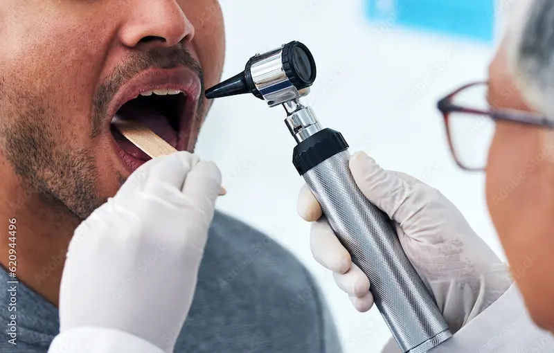 Mouth Cancer Overview Causes, Symptoms, and Treatment